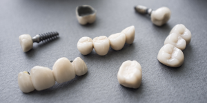 restauration dentaire couronne pont implant